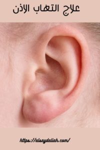 التهاب الأذن الوسطى الاسباب وافضل الادوية ملف شامل 2020 3